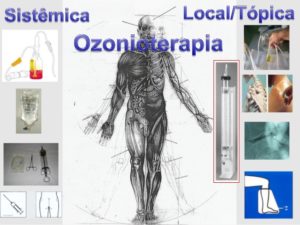 O que é Ozonioterapia e para que serve